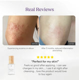 Mimone - REFINE Advance Peptide Serum